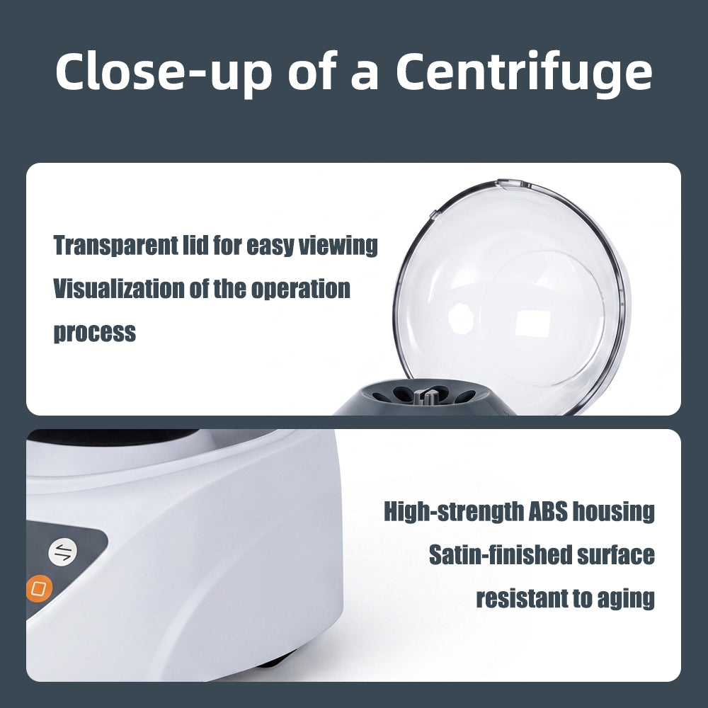 Mini Centrifuge, Laboratory Variable‑Speed Micro Centrifuge, Serum Separator for Veterinary & Pet Medical Use Yieryi